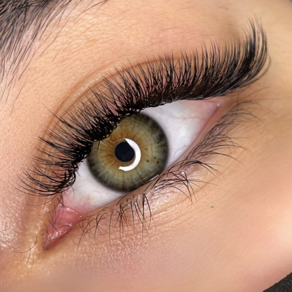 eyelash-transplant eyelash-transplant